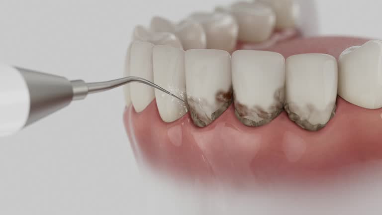 Trusted Teeth Whitening service in Clayton, MO - Dentist Open Now